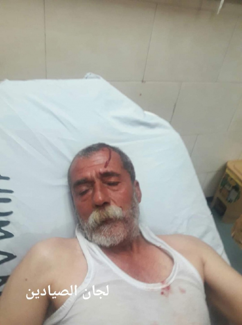 اصابة صياد بعيار مطاطي بالرأس في غزة 