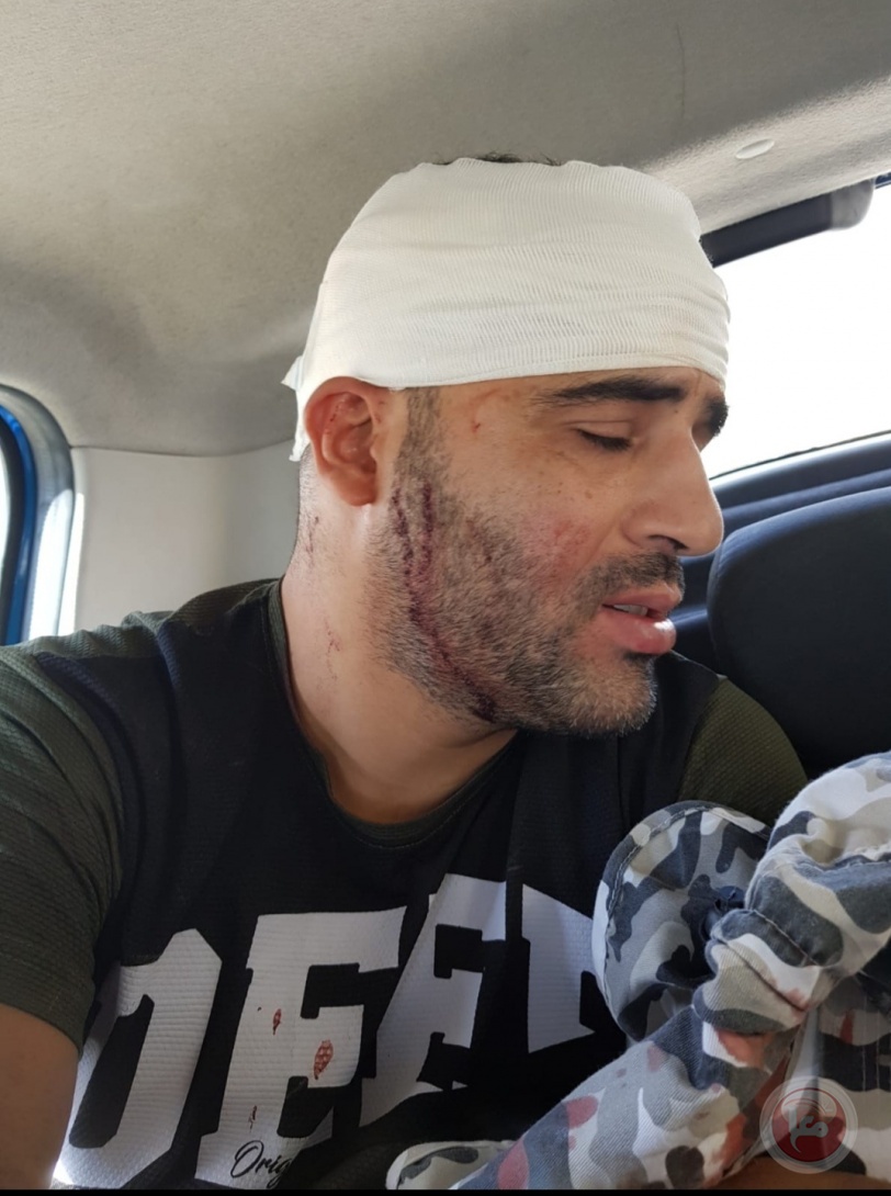 ٣ إصابات وتكسير سيارات المواطنين بهجوم للمستوطنين على بورين 