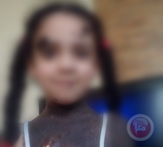 طفلة مريضة تناشد الرئيس لانقاذ حياتها
