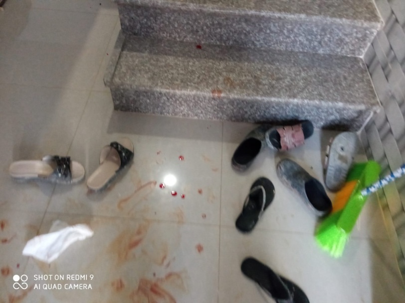 إصابة طفلة في هجوم للمستوطنين جنوب نابلس (صور)