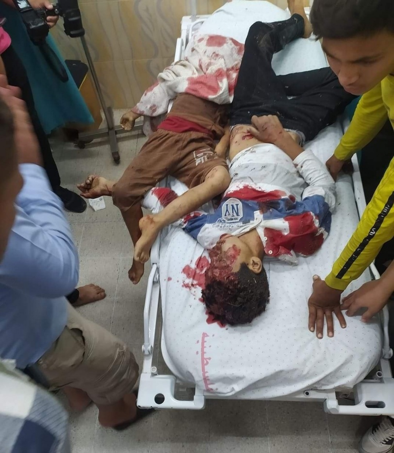 21 شهيدا و 70 اصابة جراء قصف الاحتلال على قطاع غزة 
