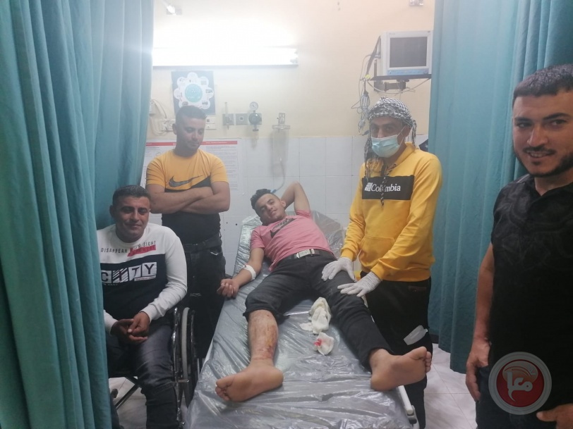 8 اصابات خلال اقتحام مستوطنين وجيش الاحتلال لقرية اللتواني شرق يطا