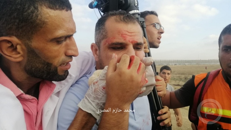غزة.. إصابات إثر قمع الاحتلال مهرجانا بذكرى إحراق الأقصى