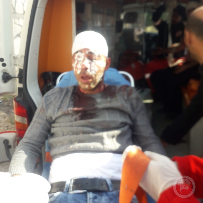 بالصور: ثلاثة إصابات وتحطيم سيارات خلال هجوم للمستوطنين غرب نابلس