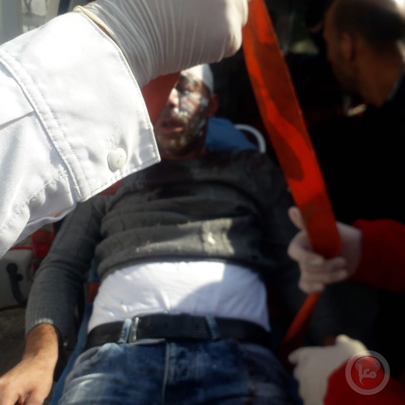بالصور: ثلاثة إصابات وتحطيم سيارات خلال هجوم للمستوطنين غرب نابلس