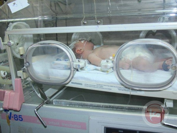 الصحة: انقاذ حياة سيدة حامل وتوائمها الثلاث بمستشفى الأوروبي