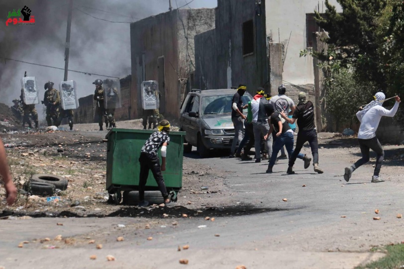 5 إصابات برصاص الاحتلال خلال قمع مسيرة كفر قدوم