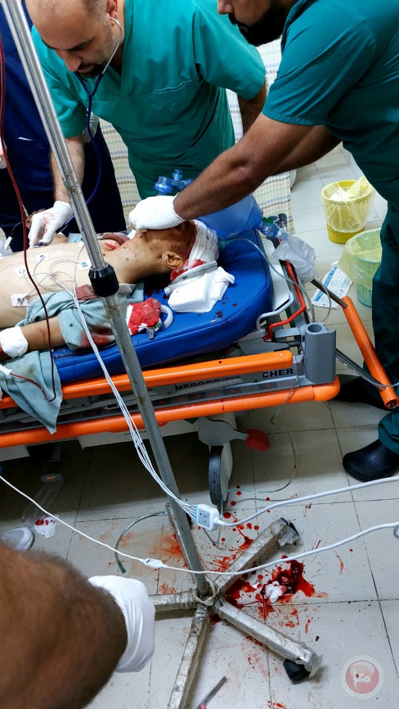 إصابة فتى بجروح حرجة برصاص الاحتلال في قلقيلية