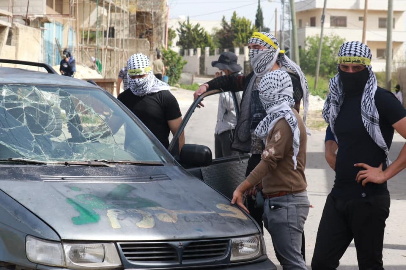 6 إصابات برصاص الاحتلال في كفر قدوم (صور)