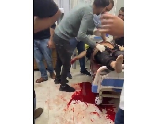 استشهاد ضابط إسعاف وإصابتان برصاص المستوطنين بقرية الساوية 