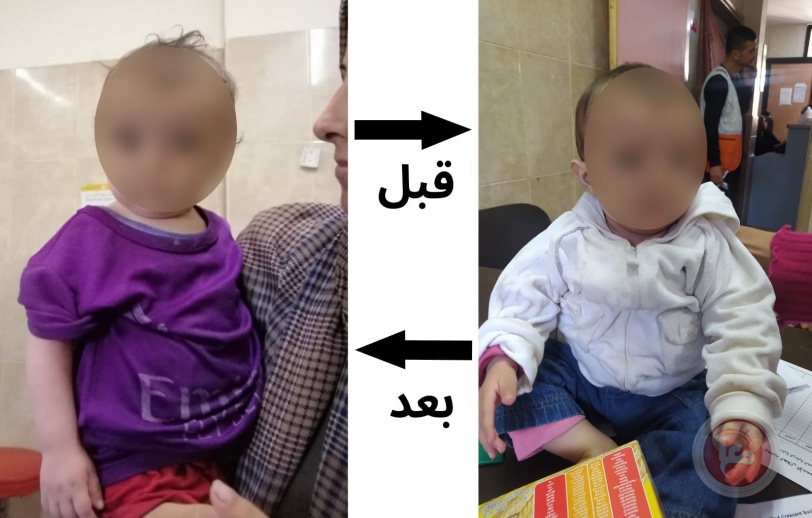 الهلال الأحمر الفلسطيني ينقذ: صور نجاحات في مكافحة سوء التغذية
