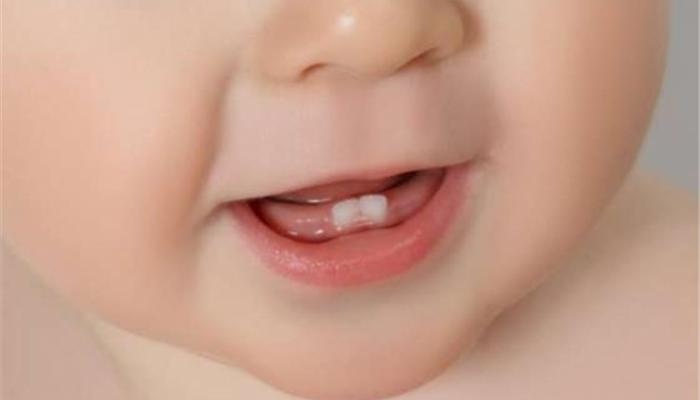 أسباب تأخر ظهور الاسنان عند الاطفال