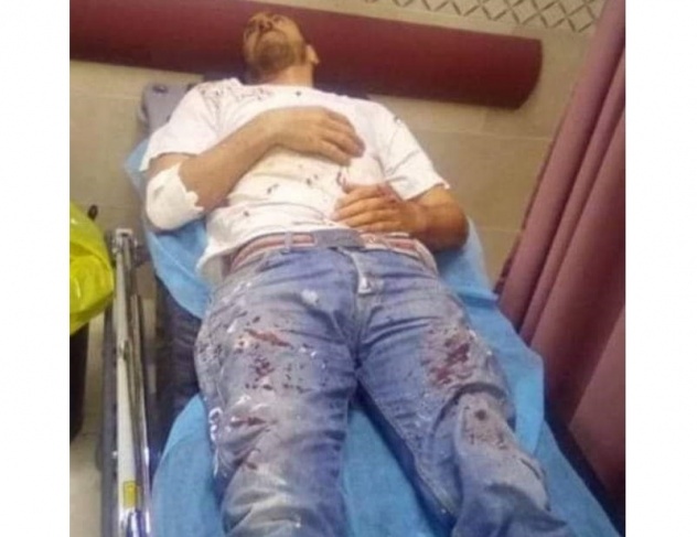 مستوطنون يعتدون على مواطن جنوب نابلس
