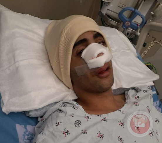 الاحتلال ينكل بعائلة عماد الطيطي من العروب- 3 اشقاء معتقلين بينهم مصاب 