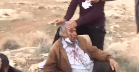 إصابة مواطنين جراء اعتداء المستوطنين على مزارعين شرق نابلس