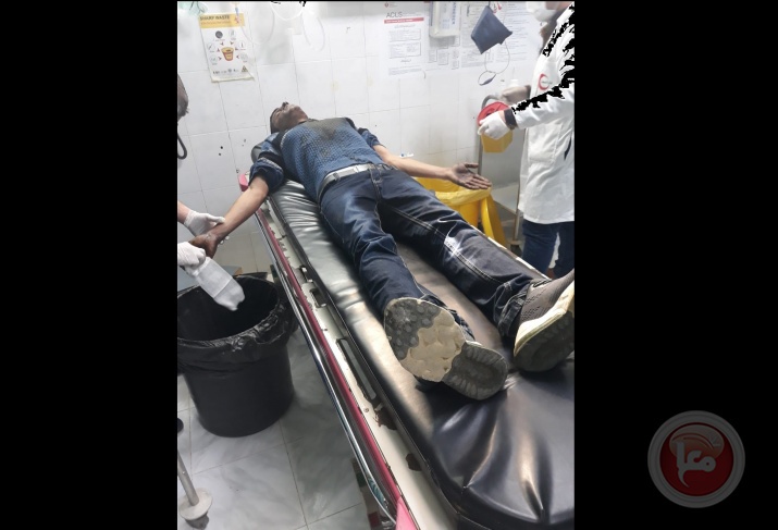 اصابة مواطن بحروق بعد انفجار جسم مشبوه جنوب الخليل
