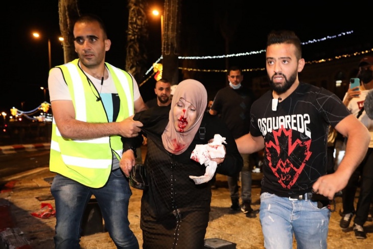 اصابات خلال مواجهات مع الاحتلال واعتقال مواطنين في باب العامود بالقدس