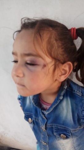 الاحتلال يعتدي بالضرب على طفلة وسيدة ويعتقل مواطنين جنوب الخليل 
