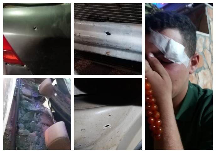 إصابة 3 مواطنين إثر اعتداء جنود الاحتلال عليهم قرب يبرود