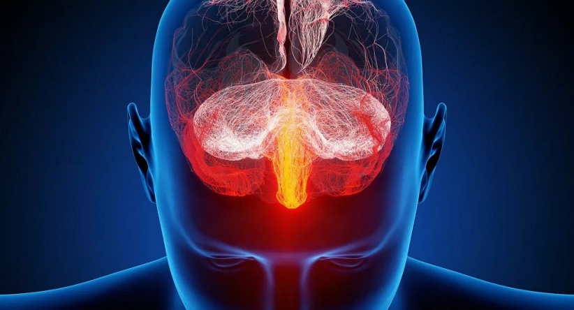 دراسة تكشف عن أعراض تظهر قبل 10 سنوات للجلطة الدماغية