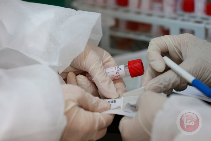 64 إصابة جديدة بفيروس كورونا في فلسطين
