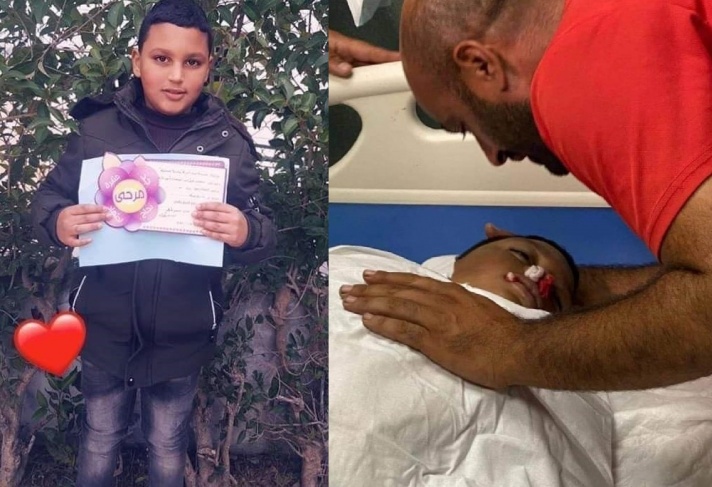 استشهاد الطفل محمد العلامي من بيت أمر متأثرا بجروحه