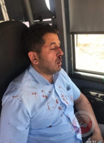 إصابة سائق حافلة مقدسي بجروح إثر اعتداء مستوطن عليه