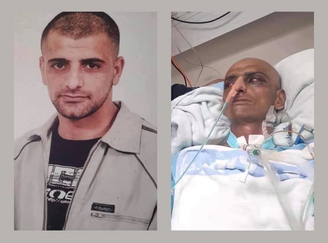 نقل الاسير السابق المصاب بالسرطان حسين مسالمة إلى الجمعية العربية