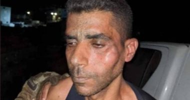 بعد تمكن المحامي من زيارته- الزبيدي تعرض للتنكيل الشديد ويعاني من كسور 