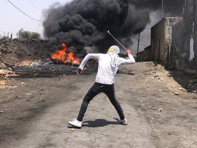 11 إصابة برصاص الاحتلال خلال قمع مسيرة كفر قدوم 