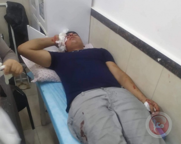 سلفيت: اصابة فتى واعتقال مواطن خلال اقتحام كفر الديك