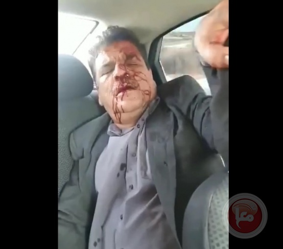 مستوطن يدهس القيادي بحركة فتح بيان الطبيب في قلقيلية(فيديو)