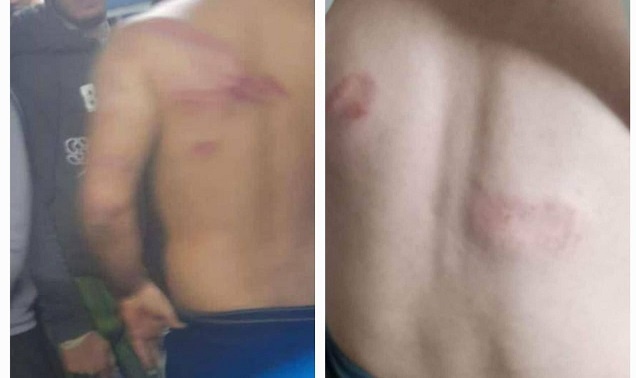 الشاباك يحقّق بخطف وتعذيب عمال فلسطينيين بالداخل المحتل