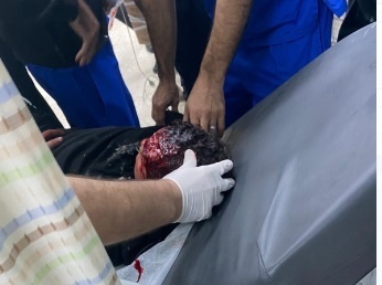 اصابة فتى برصاص الاحتلال بالرأس خلال مواجهات في اريحا 