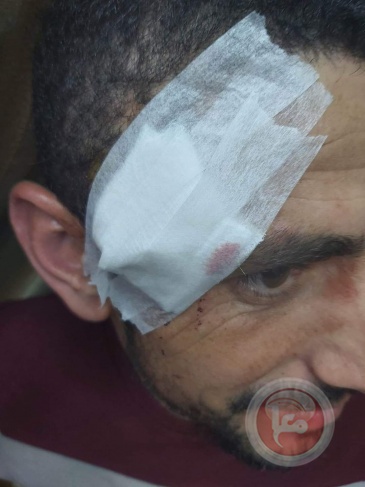 إصابة مواطنين بجروح ورضوض في اعتداء للمستوطنين غرب سلفيت