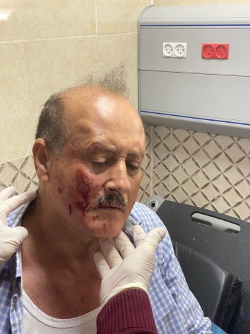 إصابة اللواء سرحان دويكات ومواطن في هجوم للمستوطنين شرق نابلس