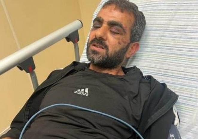أبو بكر: ما حدث مع الأسير المحرر محمد زهران جريمة قتل متدرجة 