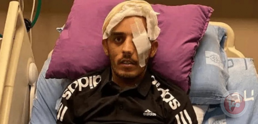 بعد عامين من الإصابة- تدهور على صحة الشاب المقدسي أحمد أبو اسنينة