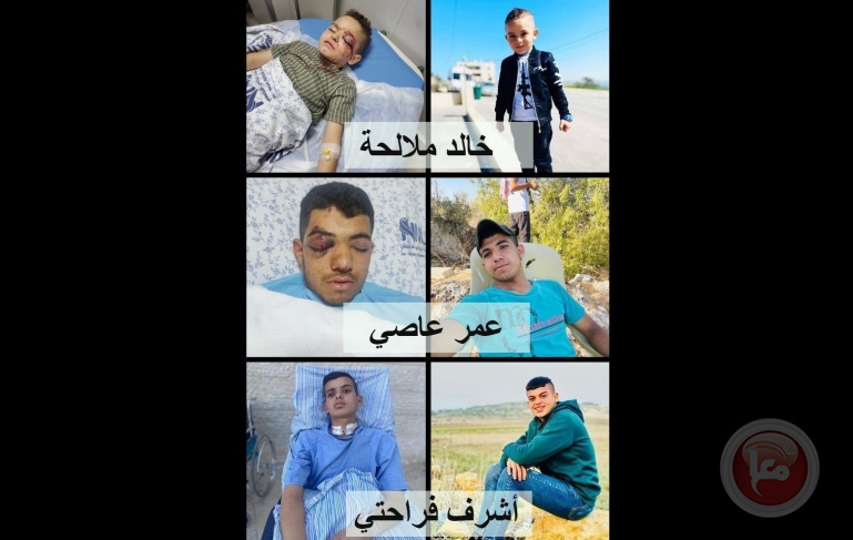 &quot;الحركة العالمية&quot;: الاحتلال يتسبب بفقدان 3 أطفال لأعينهم
