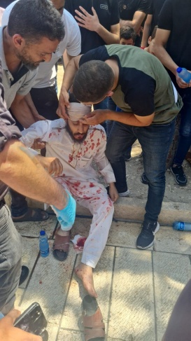 4 injured and arrested.. Repression and assault on worshipers at Lions Gate