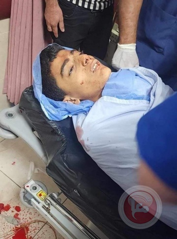 7 martyrs in the West Bank... a martyr shot by the occupation forces at the entrance to the town of Beita