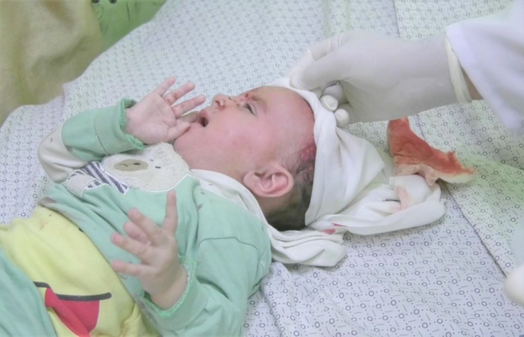 شهداء وجرحى في تواصل قصف الاحتلال لقطاع غزة 