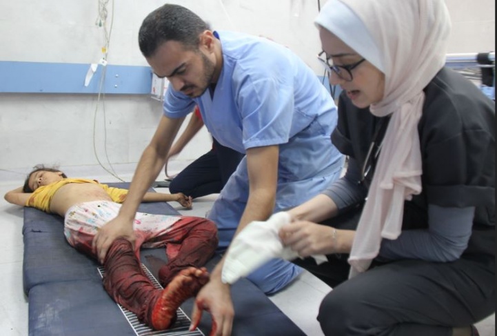 Health: 2,215 martyrs and 8,714 wounded in the occupation raids on the Gaza Strip