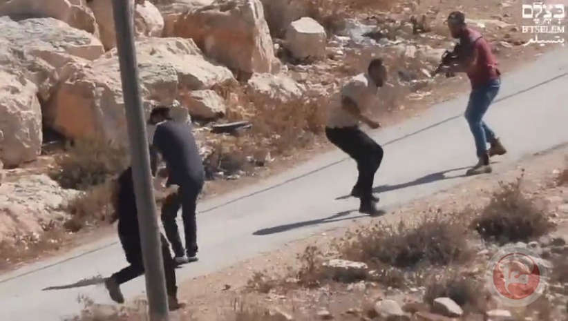 A settler shoots a citizen, seriously wounding him