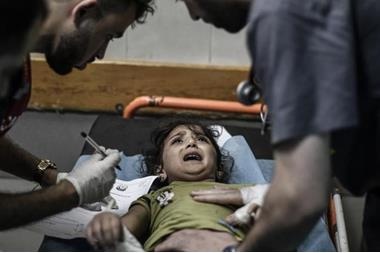 World Health: Beginning of amputations without anesthesia in Gaza