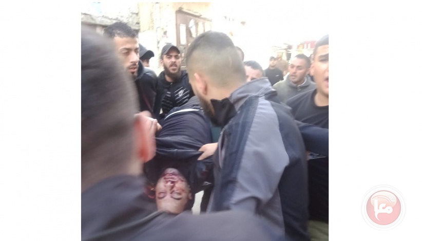 4 injuries - clashes during the occupation army’s storming of Balata camp