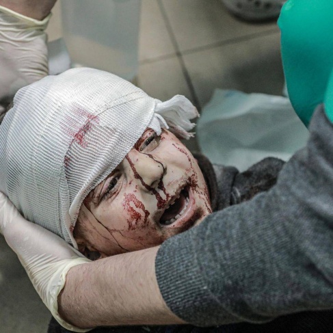غزة: 81 شهيدا خلال 24 ساعة و30035 منذ بداية الحرب