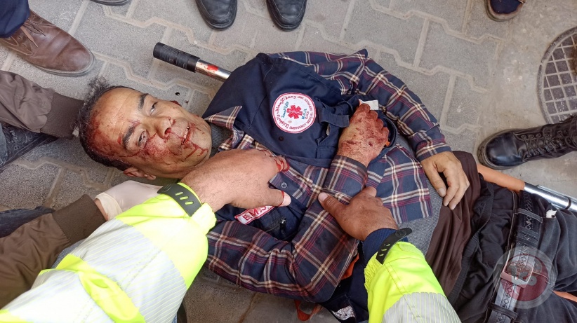 الصحة بغزة: 11 شهيد و50 اصابة بقصف اسرائيلي في محيط المشفى الاماراتي برفح