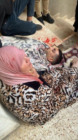 A young man was killed by occupation bullets in Nour Shams camp