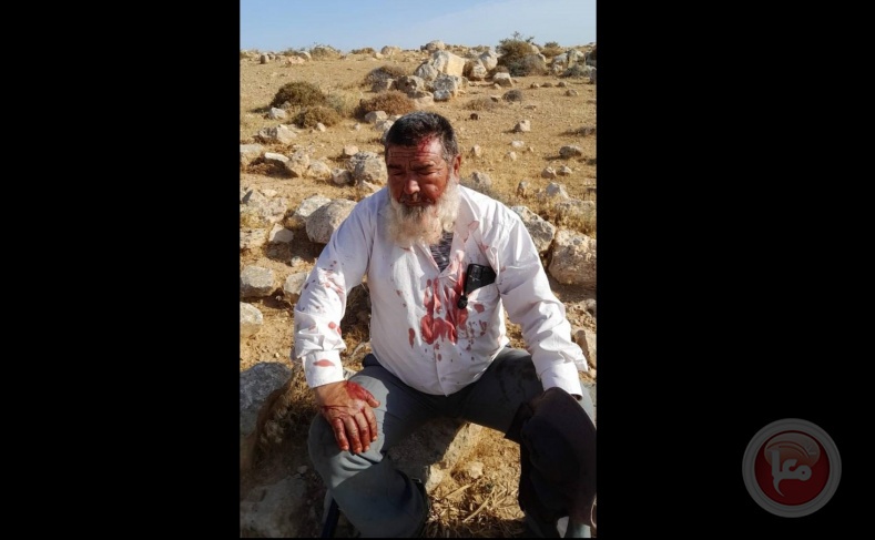 Video- Settlers beat a citizen south of Hebron